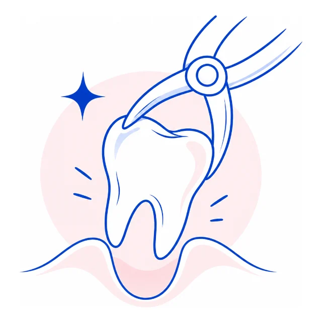 Line illustration of forceps lifting a tooth